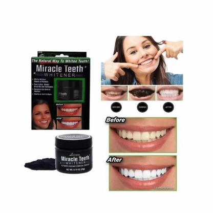 BLANQUEADOR DE DIENTES EN POLVO CON CARBÓN ACTIVADO - MIRACLE TEETH